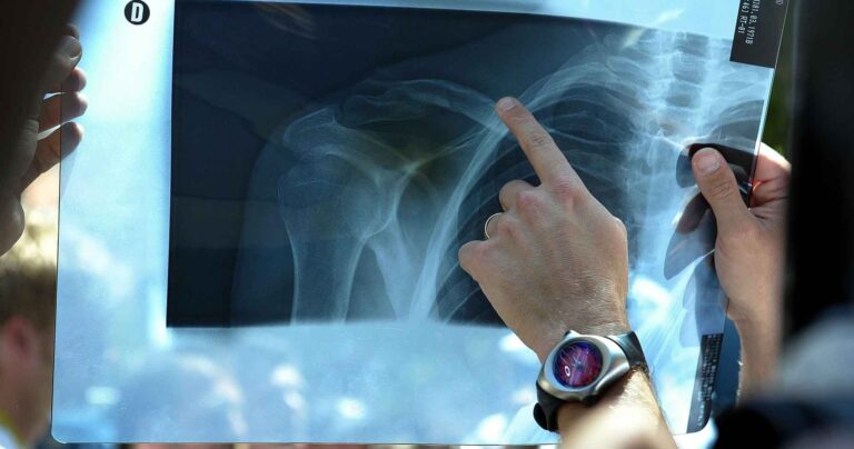 Hold i konflikten med Tour de France om CT -scanner